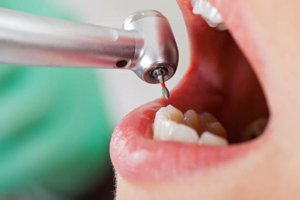 Best Lost Filling or Crown Replacement in Rio Vista, TX